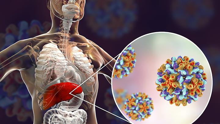 Waspada Wabah Hepatitis Bisa Jadi Pandemi Jilid 2